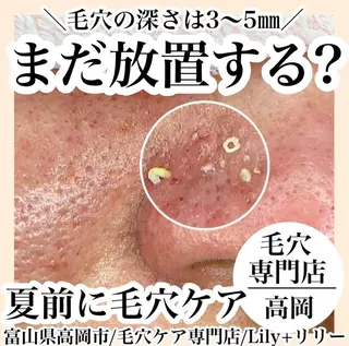 リリー yuriのエステ・リラクイメージ