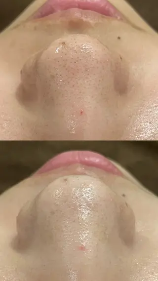 Folche三川町ア ピールポイント確認！のエステ・リラクイメージ