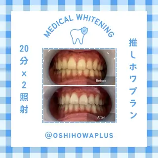 Belle plus 江坂店所属・ホワイトニング/肌管 Belle plusのその他イメージ