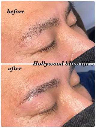 アイブロウ ハーブピーリング/韓国肌管理/フェイシャル/毛穴洗浄/眉毛/顔脱毛【糸脱毛専門】rev所属・ハーブピーリング🌹 毛穴洗浄❤️眉waxのエステ・リラクイメージ