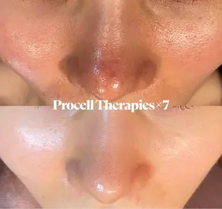 Blooming所属・LOUISE. ／肌質・頭皮のエステ・リラクイメージ