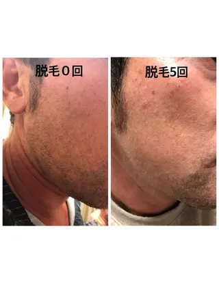 メンズ エステティシャン SAORIのエステ・リラクイメージ