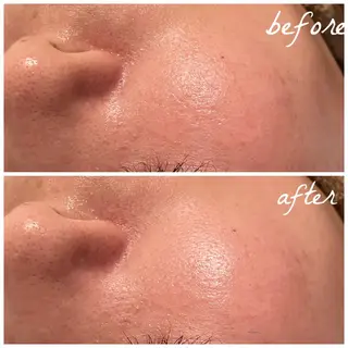 メンズ メナード岐阜市茜部 杉浦のエステ・リラクイメージ