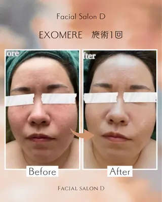 【Salon D】 HALUのエステ・リラクイメージ