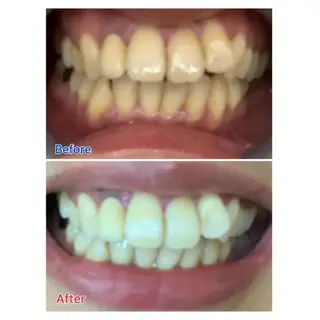 M渋谷店所属・Ｍ渋谷 ホワイトニングのエステ・リラクイメージ