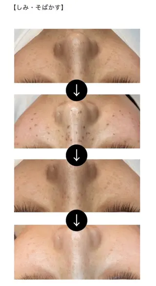 伊藤 稚菜のエステ・リラクイメージ