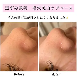 Bellesthe （ベルエステ）のエステ・リラクイメージ