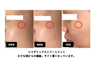 ヴィーナス ビューティーのエステ・リラクイメージ