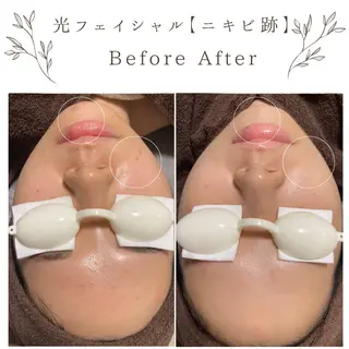 な ぎのエステ・リラクイメージ