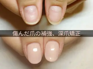 ネイル 深爪矯正/爪育成ケア manie nailのネイルデザイン