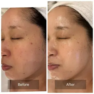 mine.mマインエム所属・mine.mi マインエムのエステ・リラクイメージ