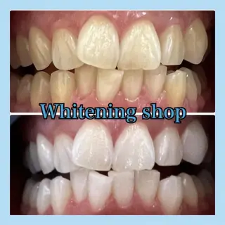 ホワイトニング ショップ千葉店のその他イメージ