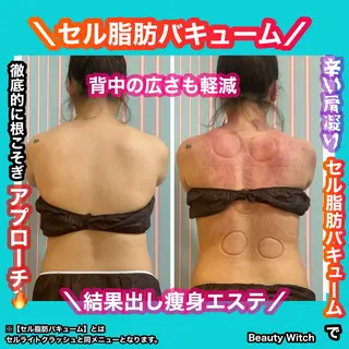 痩身/脱毛/ネイル HARUKAのエステ・リラクイメージ