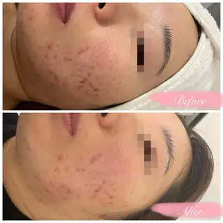 Voyage serein 【ヴォヤージュスラン】所属・心斎橋　Voyage serein🌙のマツエク・マツパデザイン