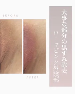 エステサロン-mignon-所属・mignon 脱毛/ ローマピンク/耳ツボのその他イメージ