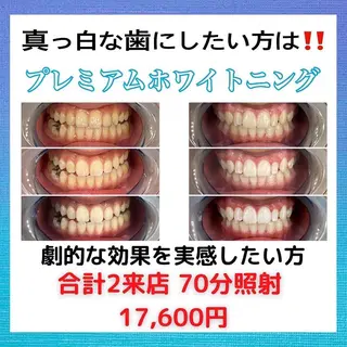 Platinum Beauty 四条烏丸店所属・吉田亮利 ホワイトニング専門店のその他イメージ