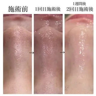 ビューティー ミロワールのエステ・リラクイメージ