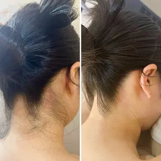 うなじ脱毛/美肌脱毛 LABELのエステ・リラクイメージ