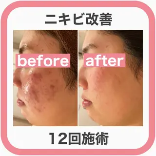 ミディアム カラー パーマ ヘアアレンジ ネイル マツエク・マツパ アイブロウ ニキビ・肌質改善専門 ♡人生が変わるサロンのエステ・リラクイメージ