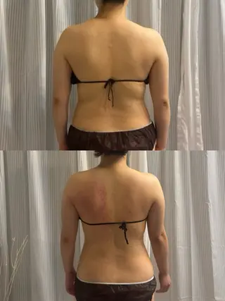 小顔|痩身salon miélu ミエルのエステ・リラクイメージ