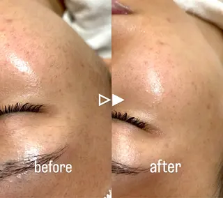 中島 菜智のヘアスタイル