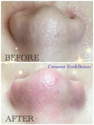 Crescent Beautyのエステ・リラクイメージ