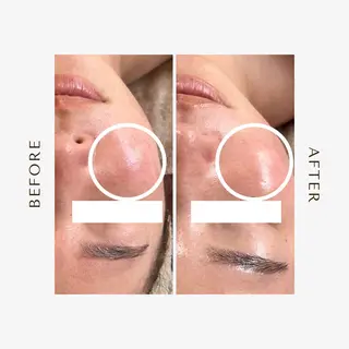 1st｜フェイシャル エステ専門店のエステ・リラクイメージ