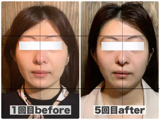 💎後悔させない小顔 矯正💎イトヤマ🌱のエステ・リラクイメージ