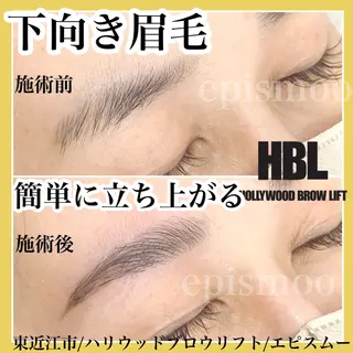 アイブロウ epismoo 脱毛/HBL/毛穴の眉毛・アイブロウイメージ