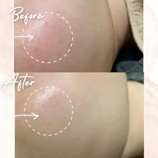 プライベートサロン　Cuara所属・Cuara 南堀江のエステ・リラクイメージ