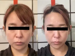 ハイフ・小顔・骨盤 シャングリラのエステ・リラクイメージ