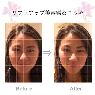 美容鍼サロン    Fleurir所属・伊藤 かなえのエステ・リラクイメージ