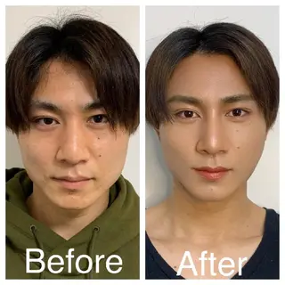 メンズ 医療提携Ruby所属・医療提携Ruby小顔 ハーブピーリングのその他イメージ