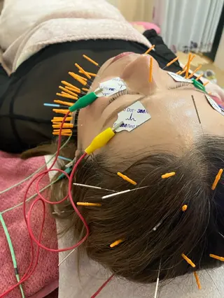 美容鍼灸女性専用 りんご鍼灸治療院のその他イメージ