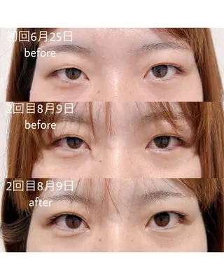 マツエク・マツパ merveilles所属・まつげ/整体/にきび ・アトピー専門サロンのマツエク・マツパデザイン