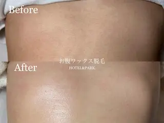 HOTEL&PARK . ワックス脱毛のエステ・リラクイメージ