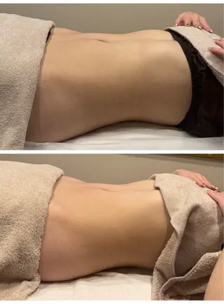 美肌脱毛サロン muroのエステ・リラクイメージ