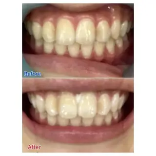 M渋谷店所属・Ｍ渋谷 ホワイトニングのエステ・リラクイメージ