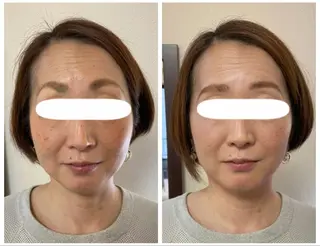 Leading Ladiesのエステ・リラクイメージ