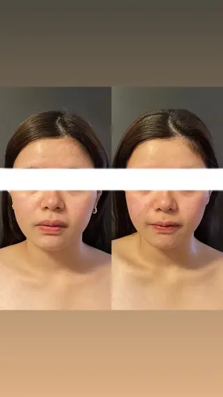 エステサロンino.colore'所属・小顔サロン ino.coloreのエステ・リラクイメージ