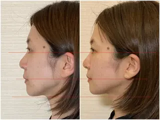 【痩身&小顔】 田淵えりこのエステ・リラクイメージ