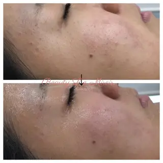 ビューティー ミロワールのエステ・リラクイメージ