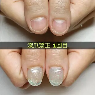 ネイル 深爪矯正/爪育成ケア manie nailのネイルデザイン