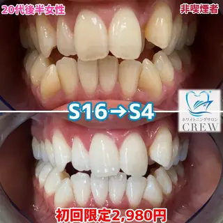 ホワイトニング ⚓︎CREW柏⚓︎のその他イメージ