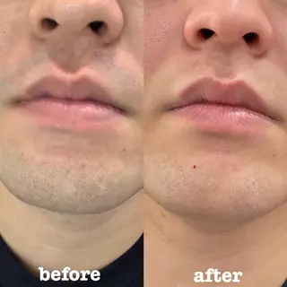 メンズ Diar salon もものエステ・リラクイメージ