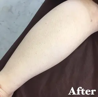 MIMI 吉祥寺本店のエステ・リラクイメージ