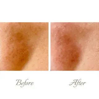 ange rose所属・竹澤 亜希子のエステ・リラクイメージ