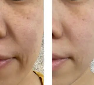 sakura room久我石原のエステ・リラクイメージ