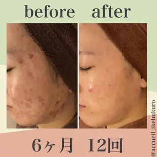 ミディアム カラー パーマ ヘアアレンジ メンズ キッズ ネイル マツエク・マツパ ニキビ・肌質改善専門 ♡人生が変わるサロンのエステ・リラクイメージ