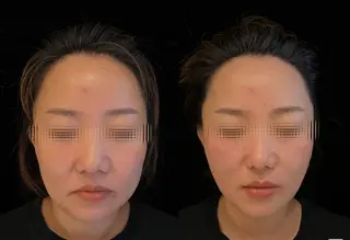 aliaハイフ&水光ジェットサロン所属・aliaハーブ水光店 エステティシャン募集のエステ・リラクイメージ